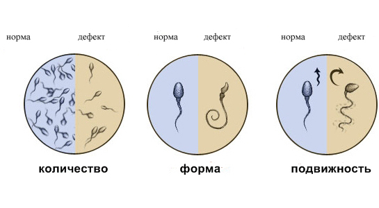 Спермограмма и анализ эякулята в Самаре